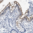 Immunohistochemical staining of human colon shows strong membranous positivity in glandular cells.