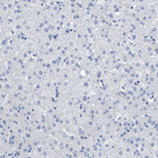 Anti-CEACAM5 Antibody