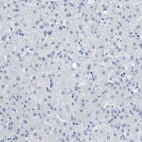 Immunohistochemical staining of human liver shows no positivity in hepatocytes as expected.