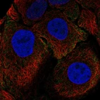 Immunofluorescent staining of human cell line HaCaT shows localization to plasma membrane.