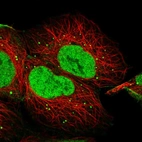 Immunofluorescent staining of human cell line HEK 293 shows localization to nucleoplasm & vesicles.