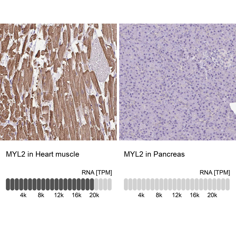Anti-MYL2 Antibody