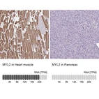 Anti-MYL2 Antibody