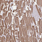 Immunohistochemical staining of human heart muscle shows moderate to strong cytoplasmic positivity in cardiomyocytes.