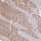 Immunohistochemical staining of human skeletal muscle shows moderate cytoplasmic positivity in myocytes.