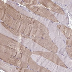 Immunohistochemical staining of human skeletal muscle shows moderate cytoplasmic positivity in myocytes.