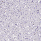 Immunohistochemical staining of human liver shows no positivity in hepatocytes as expected.