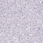 Immunohistochemical staining of human liver shows no positivity in hepatocytes as expected.