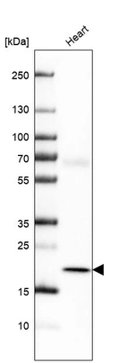 Western blot analysis in human heart tissue.