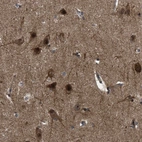 Immunohistochemical staining of human cerebral cortex shows positivity in neuronal cells.