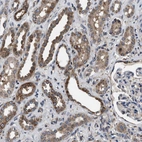 Immunohistochemical staining of human kidney shows positivity in cells in tubules.