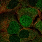 Immunofluorescent staining of human cell line U-2 OS shows localization to nucleoplasm & cytosol.