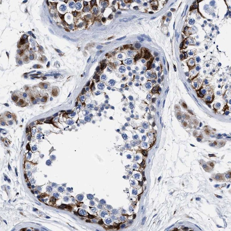 Anti-OR10G3 Antibody
