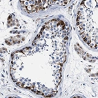 Anti-OR10G3 Antibody