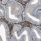Immunohistochemical staining of human endometrium shows strong cytoplasmic positivity in stromal cells.