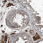 Immunohistochemical staining of human testis shows strong cytoplasmic positivity in Leydig cells.