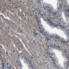 Immunohistochemical staining of human prostate shows weak cytoplasmic positivity in smooth muscle cells.