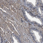 Immunohistochemical staining of human prostate shows weak cytoplasmic positivity in smooth muscle cells.