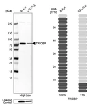 Western blot analysis in human cell lines A-431 and Caco-2 using Anti-TRIOBP antibody. Corresponding TRIOBP RNA-seq data are presented for the same cell lines. Loading control: Anti-HSP90B1.