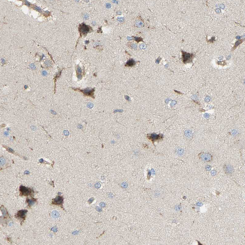 Anti-AKAP13 Antibody