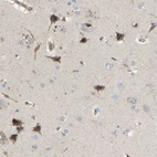 Anti-AKAP13 Antibody