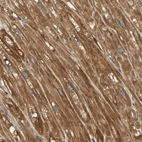Immunohistochemical staining of human heart shows moderate to strong cytoplasmic positivity in cardiomyocytes.