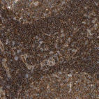 Immunohistochemical staining of human lymphoid tissues shows strong cytoplasmic positivity in lymphoid cells.