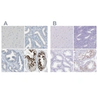 Immunohistochemical staining of human cerebral cortex, endometrium, prostate and testis using Anti-DAZL antibody HPA019777 (A) shows similar protein distribution across tissues to independent antibody HPA019593 (B).