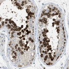 Immunohistochemical staining of human testis shows strong cytoplasmic positivity in cells in seminiferous ducts.