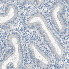 Immunohistochemical staining of human endometrium shows no positivity in glandular cells as expected.
