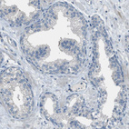 Anti-DAZL Antibody