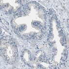 Immunohistochemical staining of human prostate shows no positivity in glandular cells as expected.