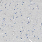 Anti-DAZL Antibody