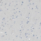 Immunohistochemical staining of human cerebral cortex shows no positivity in neurons as expected.