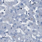 Immunohistochemical staining of human liver using Anti-GSTP1 antibody HPA019779.