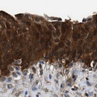 Immunohistochemical staining of human urinary bladder using Anti-GSTP1 antibody HPA019779.
