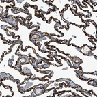 Immunohistochemical staining of human lung shows strong membranous positivity in pneumocytes.