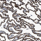 Immunohistochemical staining of human lung shows strong membranous positivity in pneumocytes.
