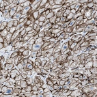 Immunohistochemical staining of human heart muscle shows strong membranous positivity in cardiomyocytes.