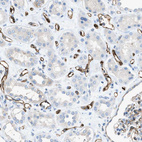 Anti-SLC22A15 Antibody