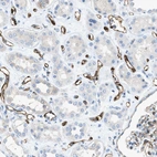 Immunohistochemical staining of human kidney shows strong membranous positivity in endothelial cells.