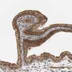 Anti-RGL1 Antibody