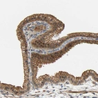 Anti-RGL1 Antibody