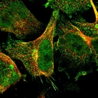 Immunofluorescent staining of human cell line U-251 MG shows localization to nucleoplasm, the Golgi apparatus & vesicles.