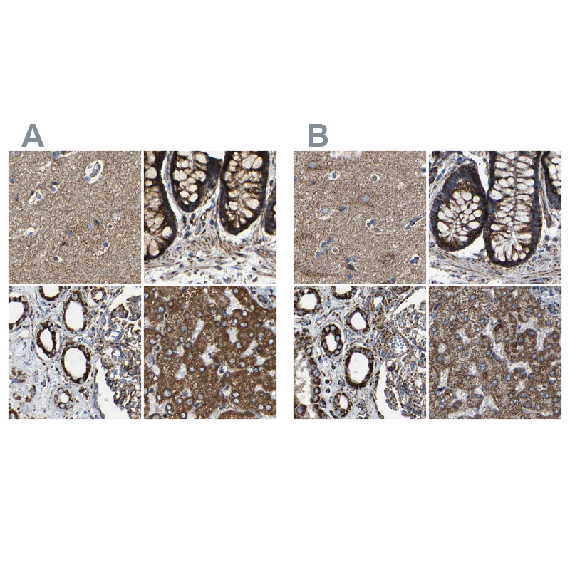 Anti-NDUFV3 Antibody