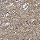 Immunohistochemical staining of human cerebral cortex using Anti-NDUFV3 antibody HPA019791.