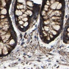 Immunohistochemical staining of human colon using Anti-NDUFV3 antibody HPA019791.