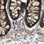 Immunohistochemical staining of human colon using Anti-NDUFV3 antibody HPA019791.