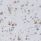 Anti-EIF2AK2 Antibody