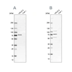Western blot analysis using Anti-EIF2AK2 antibody HPA019795 (A) shows similar pattern to independent antibody HPA063893 (B).